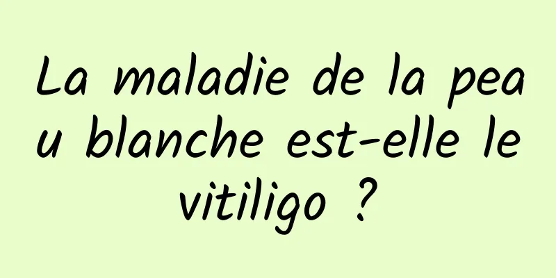 La maladie de la peau blanche est-elle le vitiligo ? 