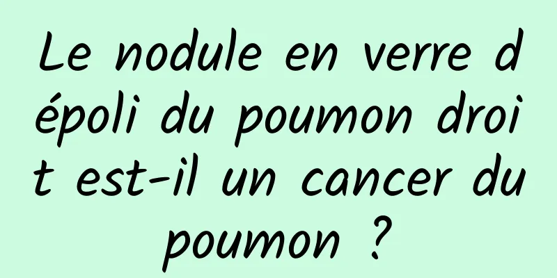 Le nodule en verre dépoli du poumon droit est-il un cancer du poumon ? 