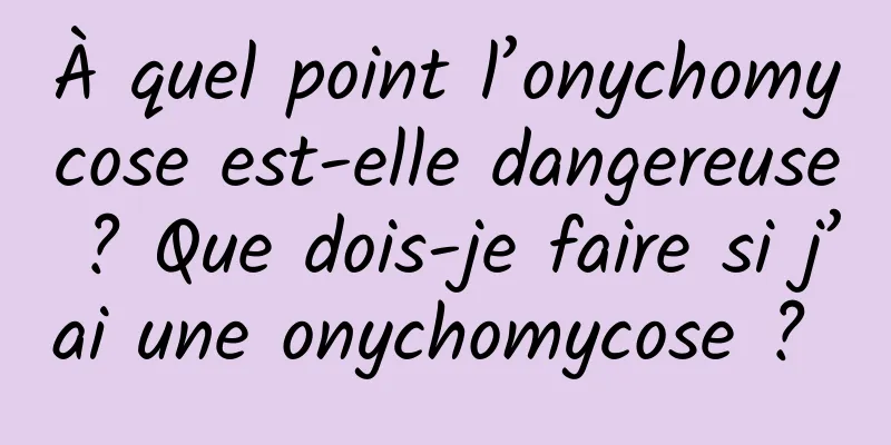 À quel point l’onychomycose est-elle dangereuse ? Que dois-je faire si j’ai une onychomycose ? 