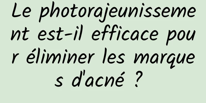 Le photorajeunissement est-il efficace pour éliminer les marques d'acné ? 