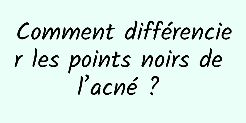 Comment différencier les points noirs de l’acné ? 