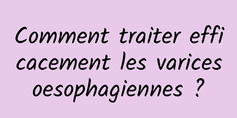 Comment traiter efficacement les varices oesophagiennes ? 