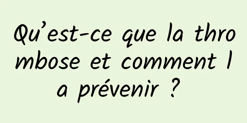 Qu’est-ce que la thrombose et comment la prévenir ? 