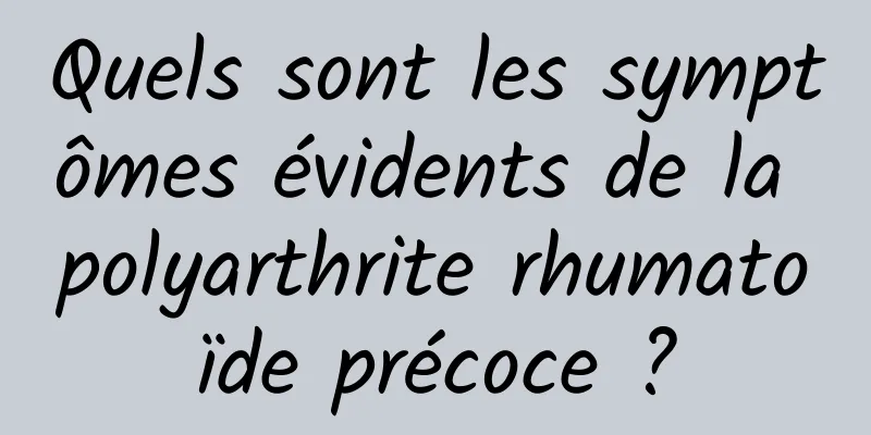 Quels sont les symptômes évidents de la polyarthrite rhumatoïde précoce ?