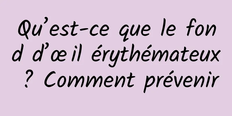 Qu’est-ce que le fond d’œil érythémateux ? Comment prévenir