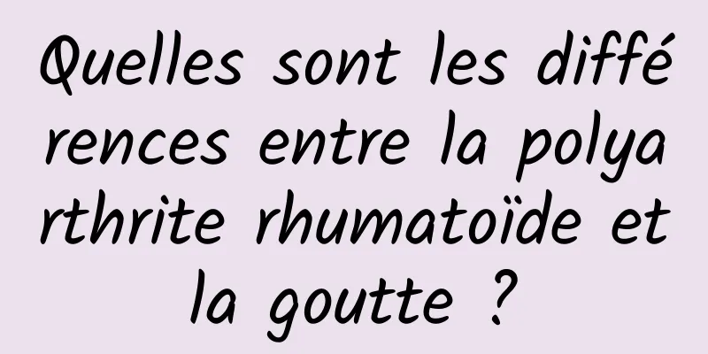 Quelles sont les différences entre la polyarthrite rhumatoïde et la goutte ? 