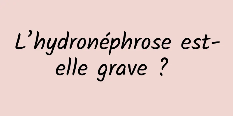 L’hydronéphrose est-elle grave ? 