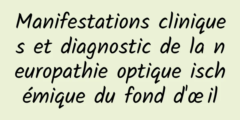 Manifestations cliniques et diagnostic de la neuropathie optique ischémique du fond d'œil