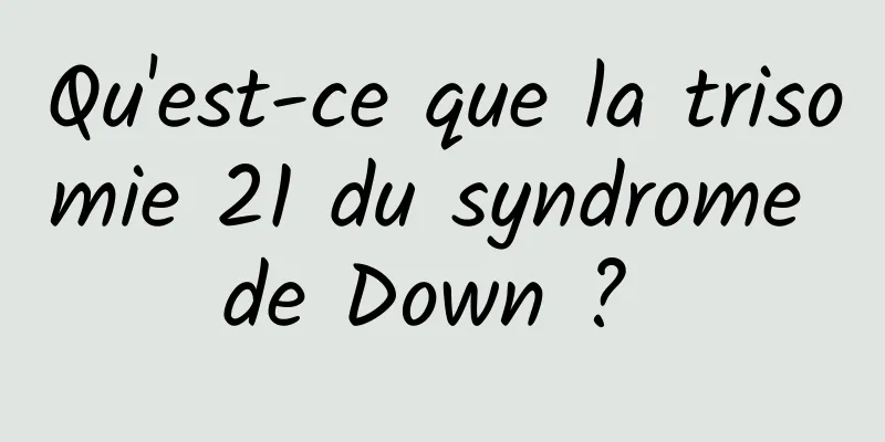 Qu'est-ce que la trisomie 21 du syndrome de Down ? 