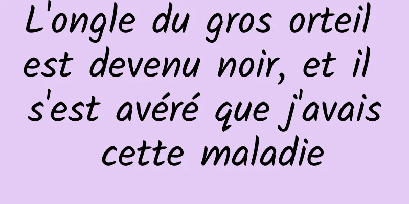 L'ongle du gros orteil est devenu noir, et il s'est avéré que j'avais cette maladie