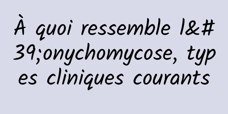 À quoi ressemble l'onychomycose, types cliniques courants