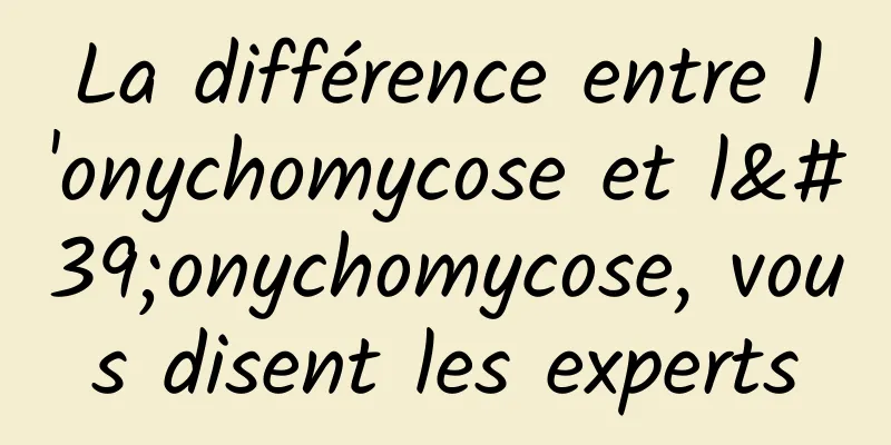 La différence entre l'onychomycose et l'onychomycose, vous disent les experts