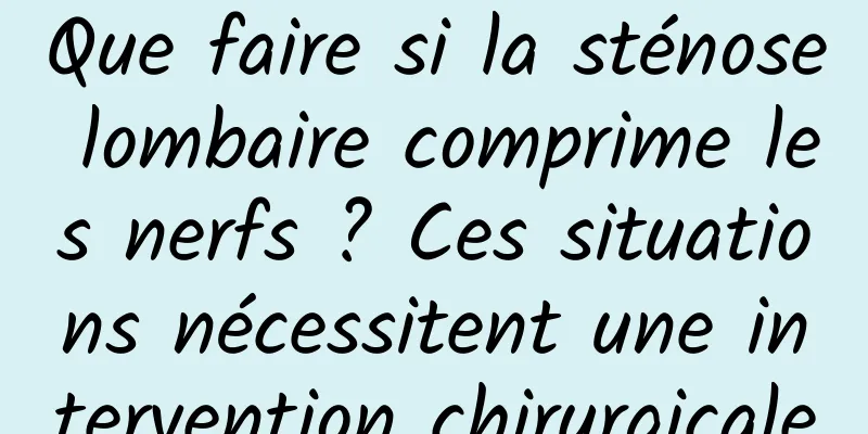 Que faire si la sténose lombaire comprime les nerfs ? Ces situations nécessitent une intervention chirurgicale