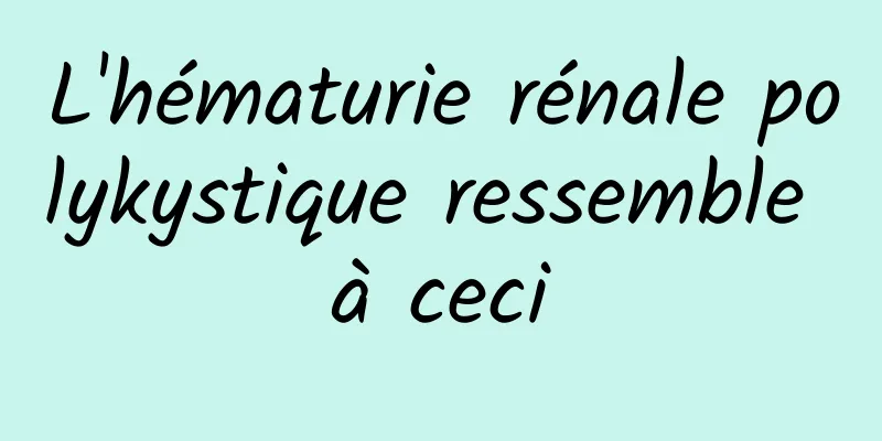 L'hématurie rénale polykystique ressemble à ceci