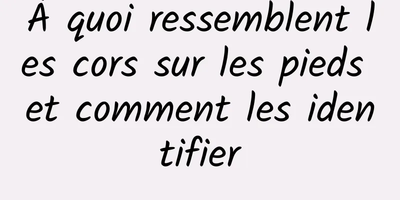 À quoi ressemblent les cors sur les pieds et comment les identifier