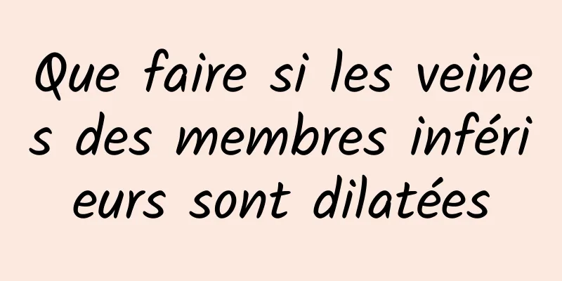 Que faire si les veines des membres inférieurs sont dilatées