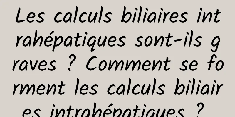 Les calculs biliaires intrahépatiques sont-ils graves ? Comment se forment les calculs biliaires intrahépatiques ? 