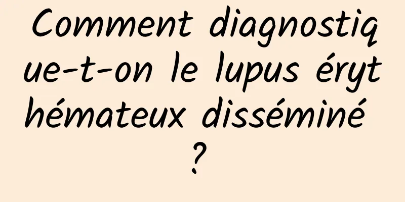 Comment diagnostique-t-on le lupus érythémateux disséminé ? 