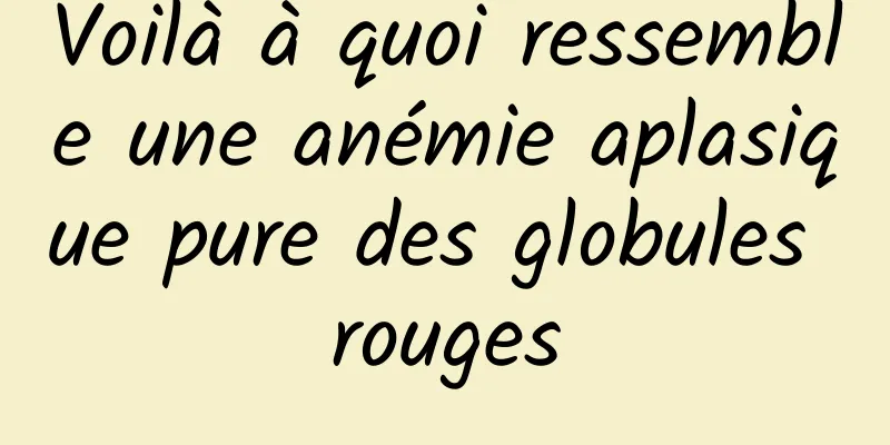 Voilà à quoi ressemble une anémie aplasique pure des globules rouges