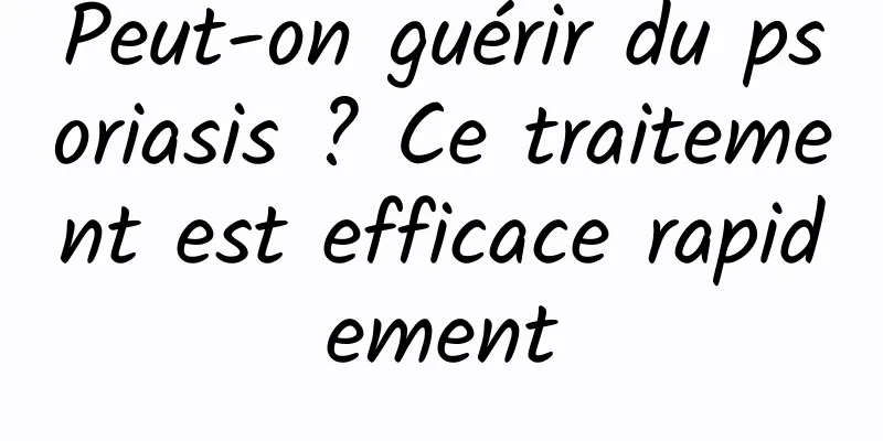 Peut-on guérir du psoriasis ? Ce traitement est efficace rapidement