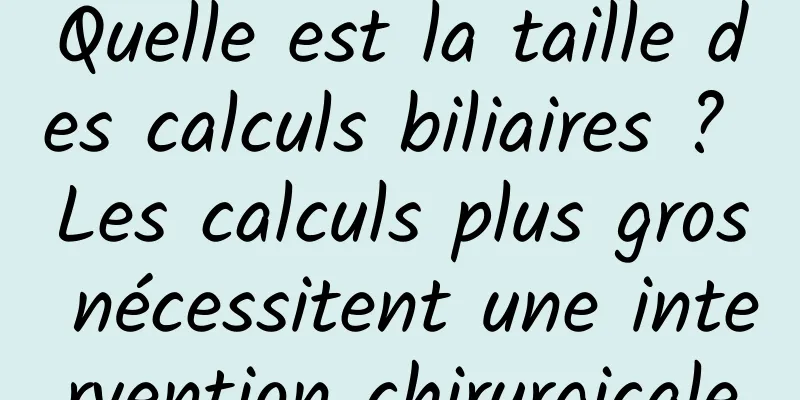 Quelle est la taille des calculs biliaires ? Les calculs plus gros nécessitent une intervention chirurgicale