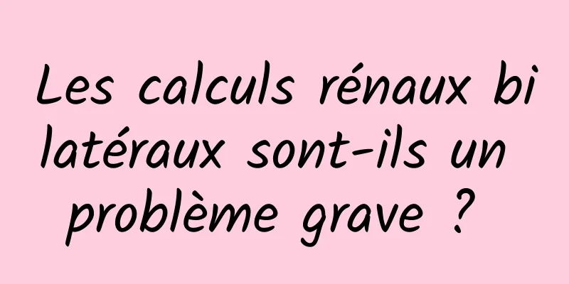 Les calculs rénaux bilatéraux sont-ils un problème grave ? 