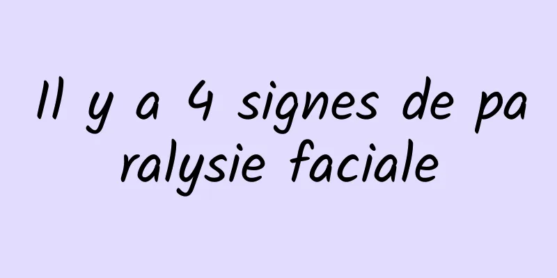 Il y a 4 signes de paralysie faciale