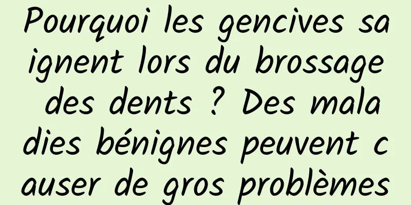 Pourquoi les gencives saignent lors du brossage des dents ? Des maladies bénignes peuvent causer de gros problèmes