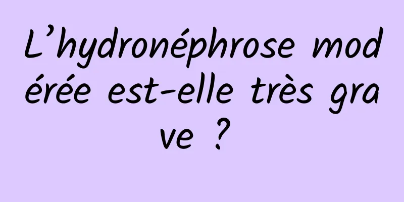 L’hydronéphrose modérée est-elle très grave ? 