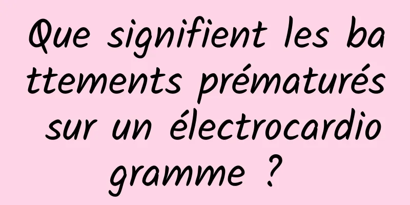 Que signifient les battements prématurés sur un électrocardiogramme ? 