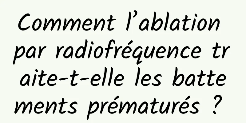 Comment l’ablation par radiofréquence traite-t-elle les battements prématurés ? 