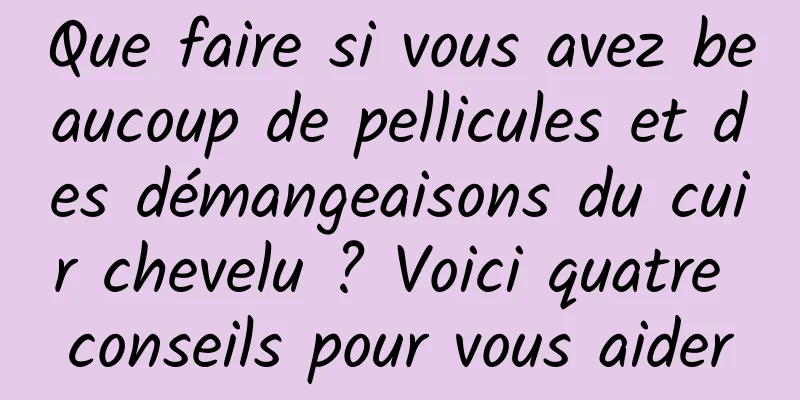 Que faire si vous avez beaucoup de pellicules et des démangeaisons du cuir chevelu ? Voici quatre conseils pour vous aider