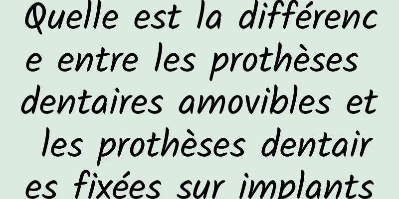 Quelle est la différence entre les prothèses dentaires amovibles et les prothèses dentaires fixées sur implants