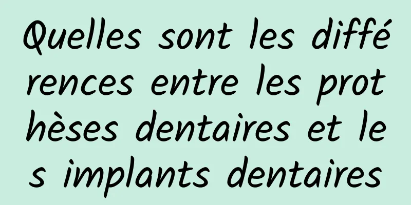 Quelles sont les différences entre les prothèses dentaires et les implants dentaires