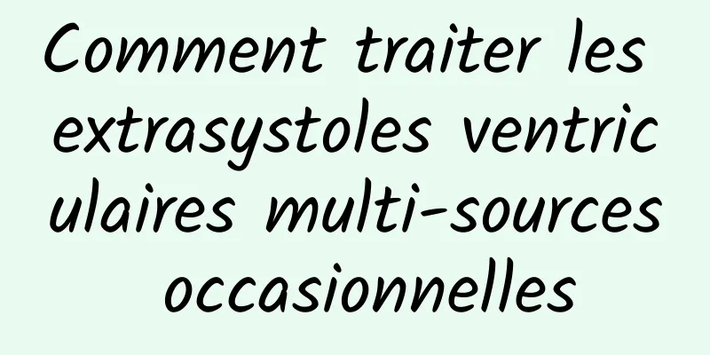 Comment traiter les extrasystoles ventriculaires multi-sources occasionnelles