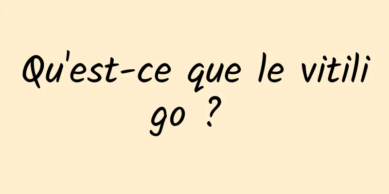 Qu'est-ce que le vitiligo ? 