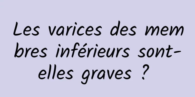 Les varices des membres inférieurs sont-elles graves ? 