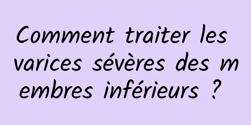 Comment traiter les varices sévères des membres inférieurs ? 