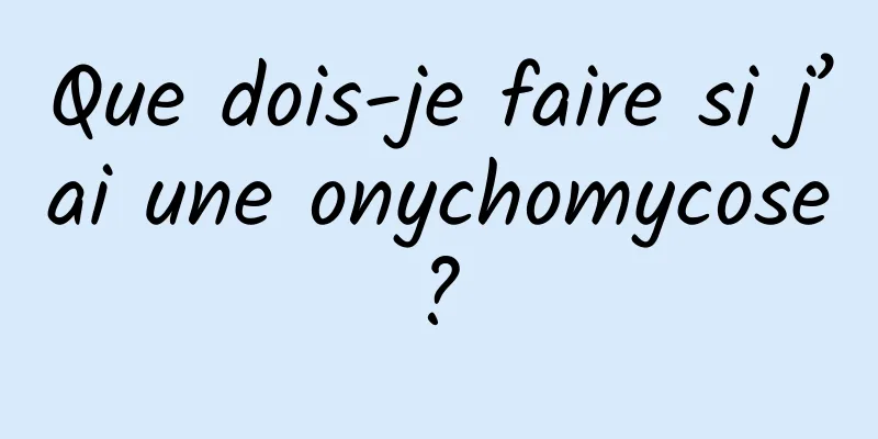 Que dois-je faire si j’ai une onychomycose ? 