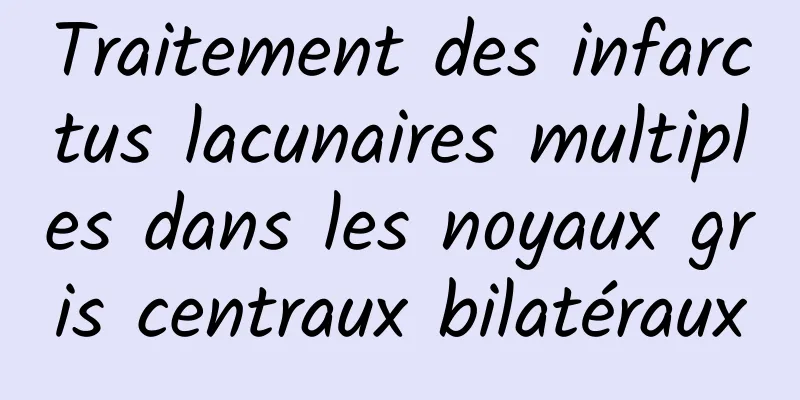 Traitement des infarctus lacunaires multiples dans les noyaux gris centraux bilatéraux