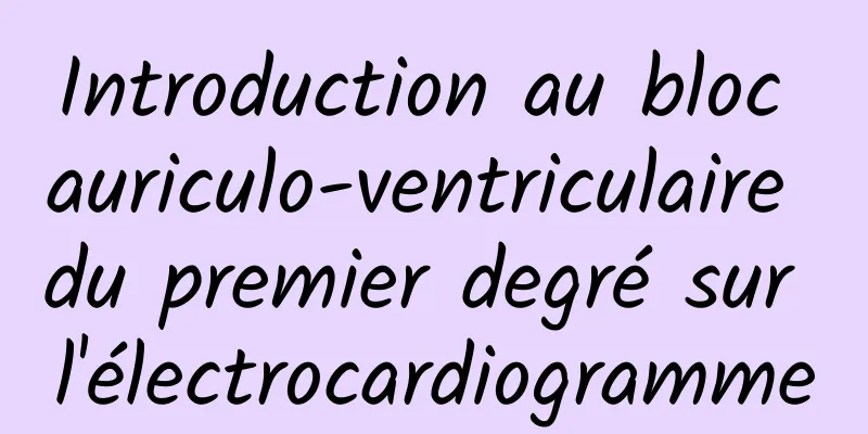 Introduction au bloc auriculo-ventriculaire du premier degré sur l'électrocardiogramme