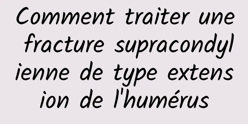 Comment traiter une fracture supracondylienne de type extension de l'humérus