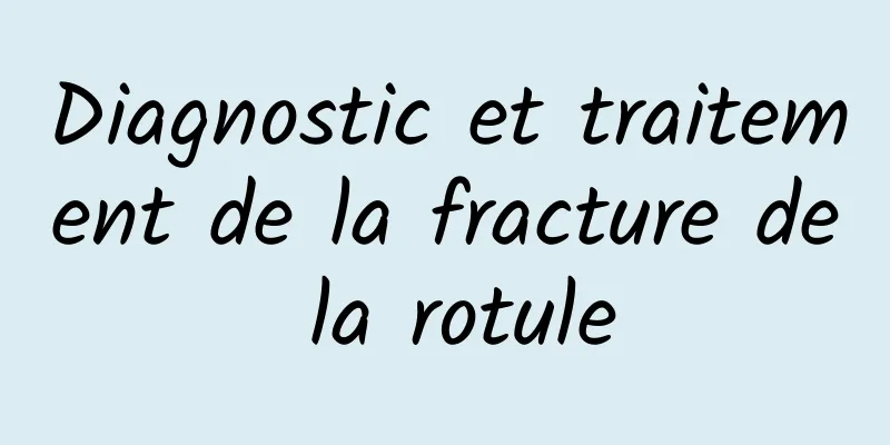 Diagnostic et traitement de la fracture de la rotule