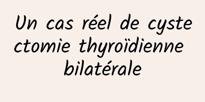 Un cas réel de cystectomie thyroïdienne bilatérale