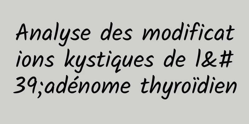 Analyse des modifications kystiques de l'adénome thyroïdien