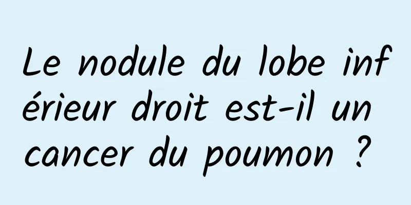 Le nodule du lobe inférieur droit est-il un cancer du poumon ? 