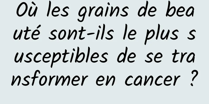 Où les grains de beauté sont-ils le plus susceptibles de se transformer en cancer ?