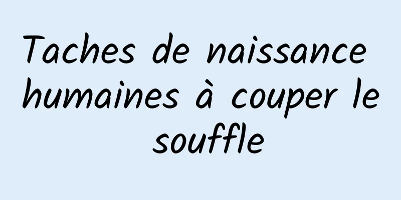 Taches de naissance humaines à couper le souffle