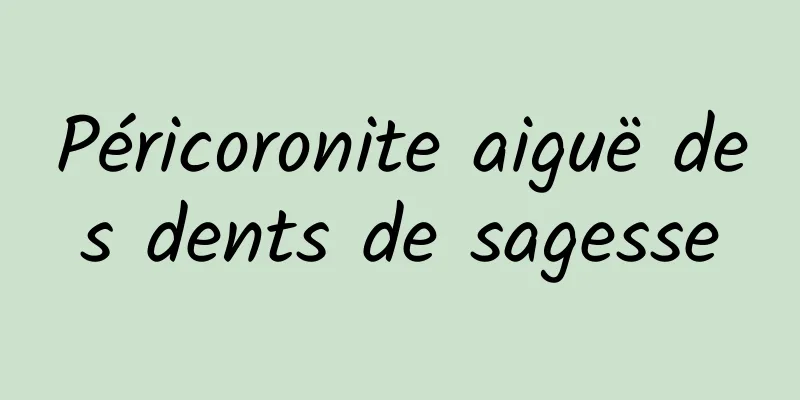 Péricoronite aiguë des dents de sagesse