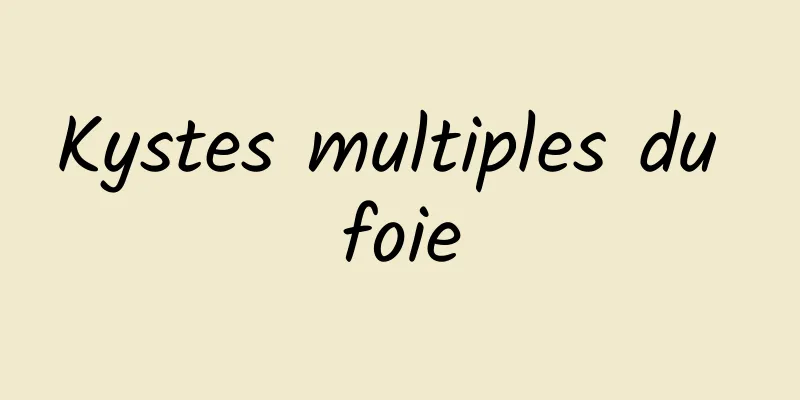 Kystes multiples du foie